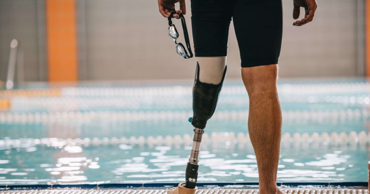 What are the Benefits of Prosthetics Insurance? | Fish Insurance