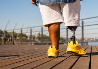 Prosthetic Leg user walking on a boardwalk - header image.